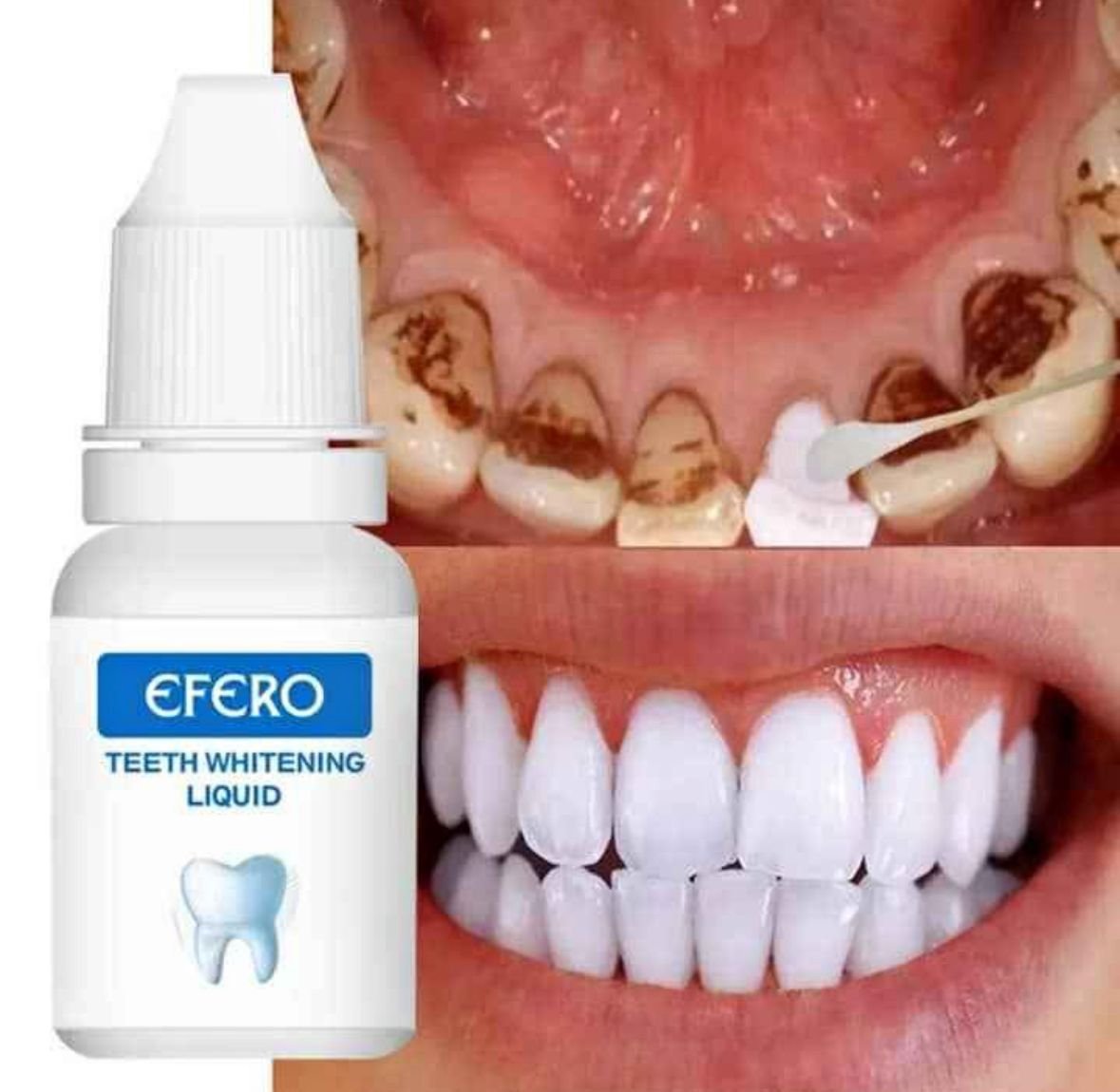 EFERO - Blanchisseur de Dents